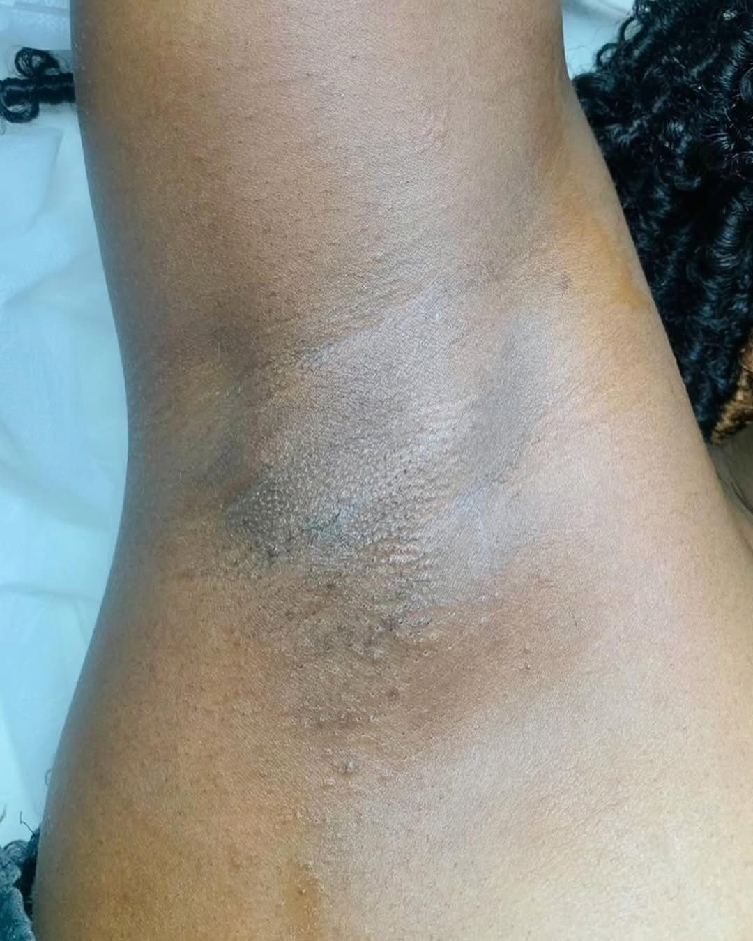 Skin texture closeup